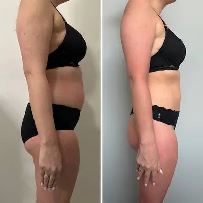 Studio pięknego ciała LadnaJa